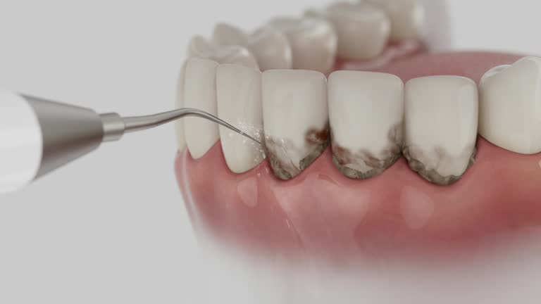 Trusted Teeth Cleaning And Checkup service in North Windham, ME - Dentist Open Now